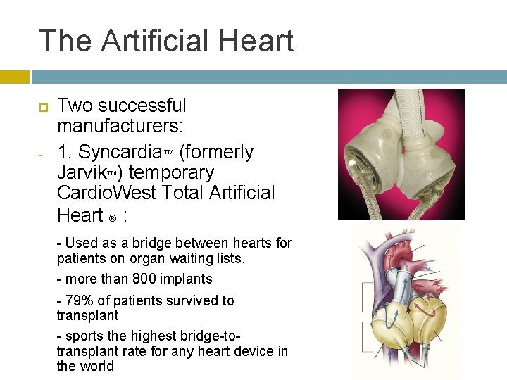 The Artificial Heart - Two successful manufacturers: 1. Syncardia™ (formerly Jarvik™) temporary Cardio. West