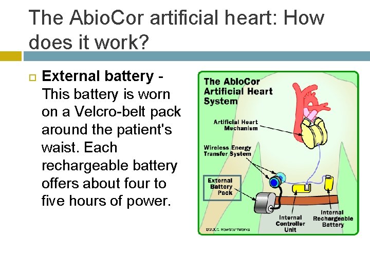 The Abio. Cor artificial heart: How does it work? External battery This battery is