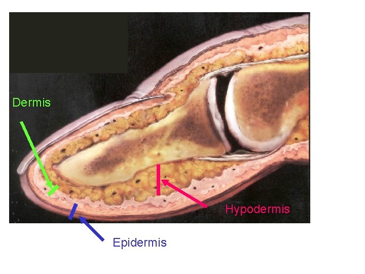 Dermis Hypodermis Epidermis 