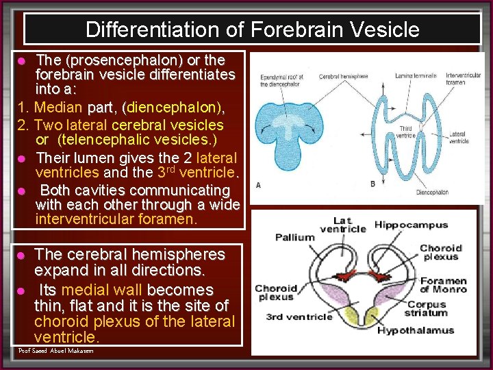 Differentiation of Forebrain Vesicle The (prosencephalon) or the forebrain vesicle differentiates into a: 1.