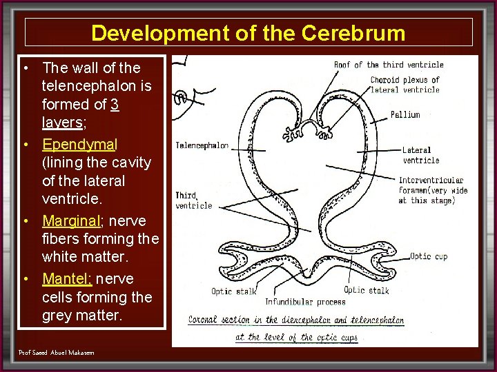 Development of the Cerebrum • The wall of the telencephalon is formed of 3