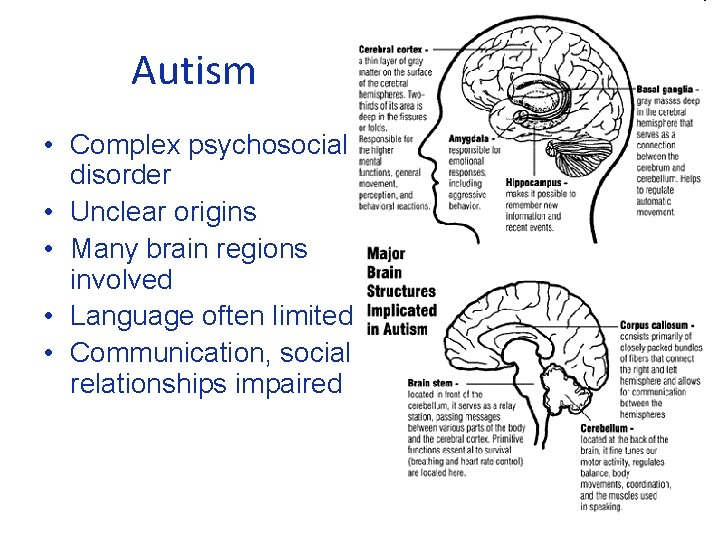 Autism • Complex psychosocial disorder • Unclear origins • Many brain regions involved •