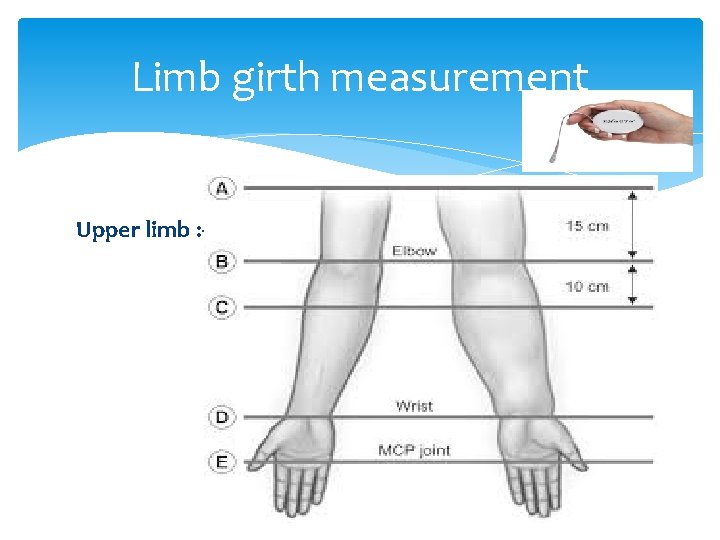 Limb girth measurement Upper limb : - 