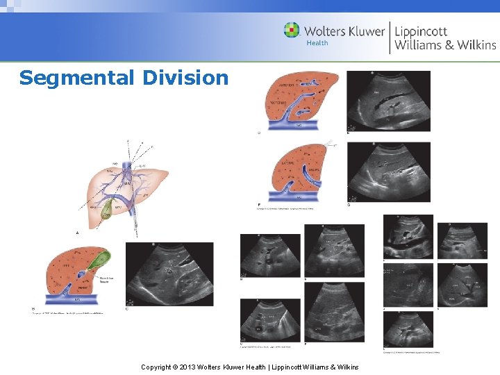 Segmental Division Copyright © 2013 Wolters Kluwer Health | Lippincott Williams & Wilkins 