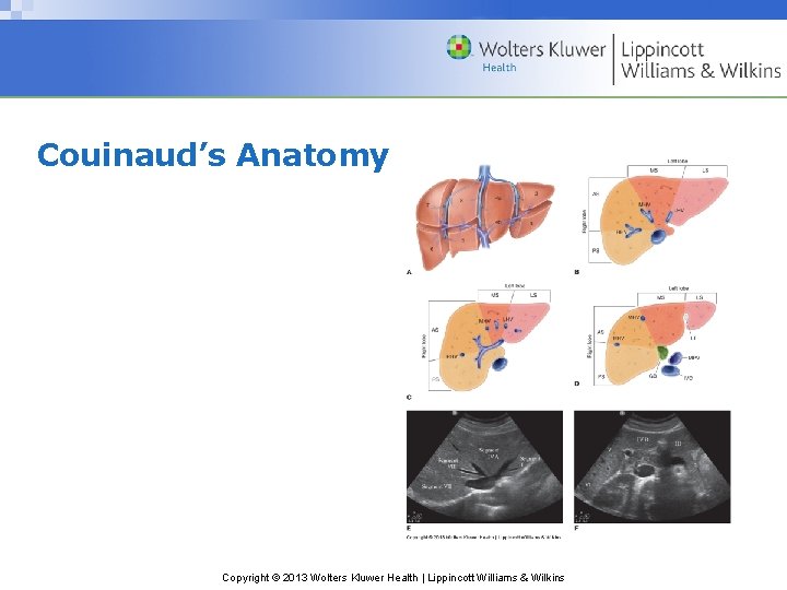 Couinaud’s Anatomy Copyright © 2013 Wolters Kluwer Health | Lippincott Williams & Wilkins 