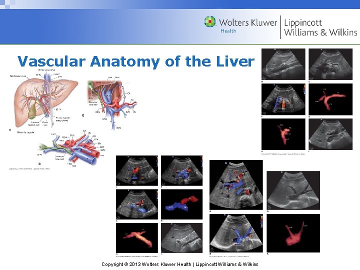 Vascular Anatomy of the Liver Copyright © 2013 Wolters Kluwer Health | Lippincott Williams