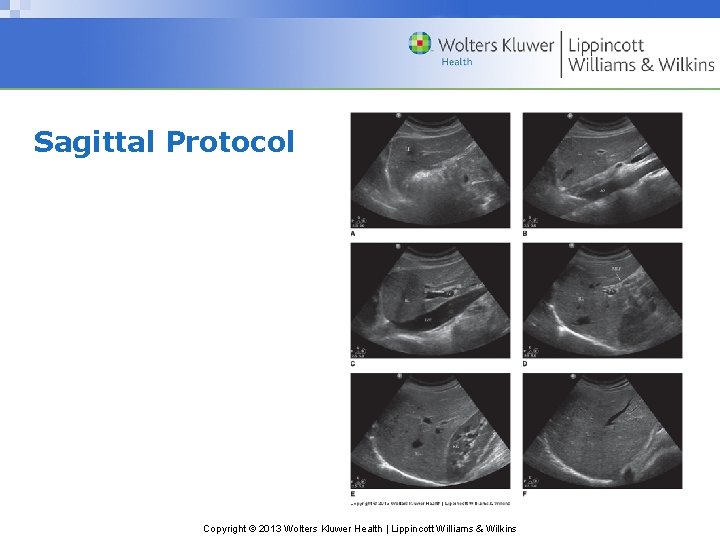 Sagittal Protocol Copyright © 2013 Wolters Kluwer Health | Lippincott Williams & Wilkins 