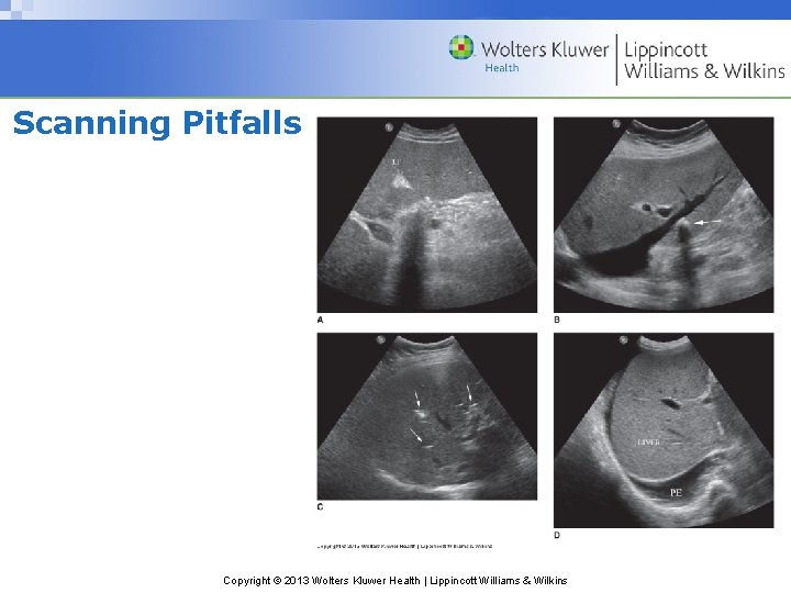 Scanning Pitfalls Copyright © 2013 Wolters Kluwer Health | Lippincott Williams & Wilkins 