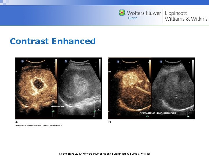 Contrast Enhanced Copyright © 2013 Wolters Kluwer Health | Lippincott Williams & Wilkins 