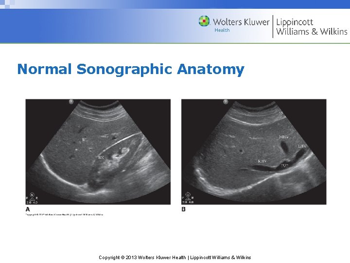 Normal Sonographic Anatomy Copyright © 2013 Wolters Kluwer Health | Lippincott Williams & Wilkins