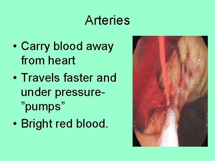 Arteries • Carry blood away from heart • Travels faster and under pressure”pumps” •