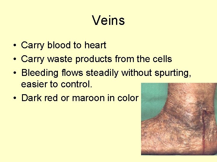 Veins • Carry blood to heart • Carry waste products from the cells •