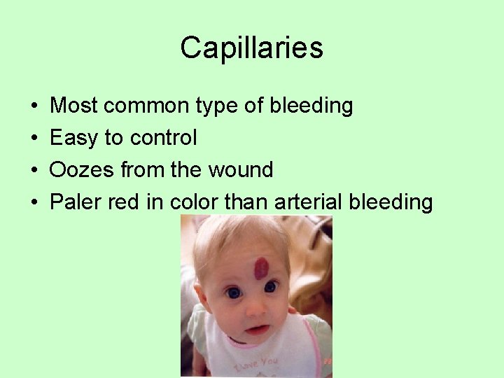 Capillaries • • Most common type of bleeding Easy to control Oozes from the