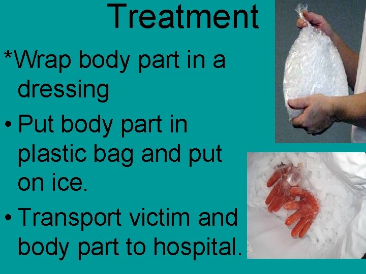 Treatment *Wrap body part in a dressing • Put body part in plastic bag