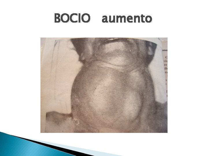 BOCIO aumento 