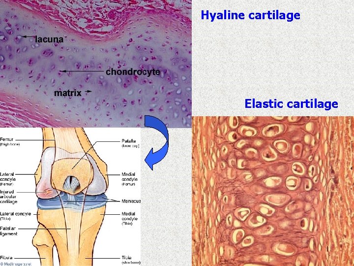 Hyaline cartilage Elastic cartilage 