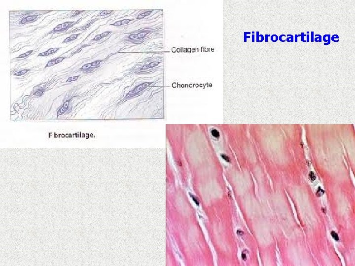 Fibrocartilage 