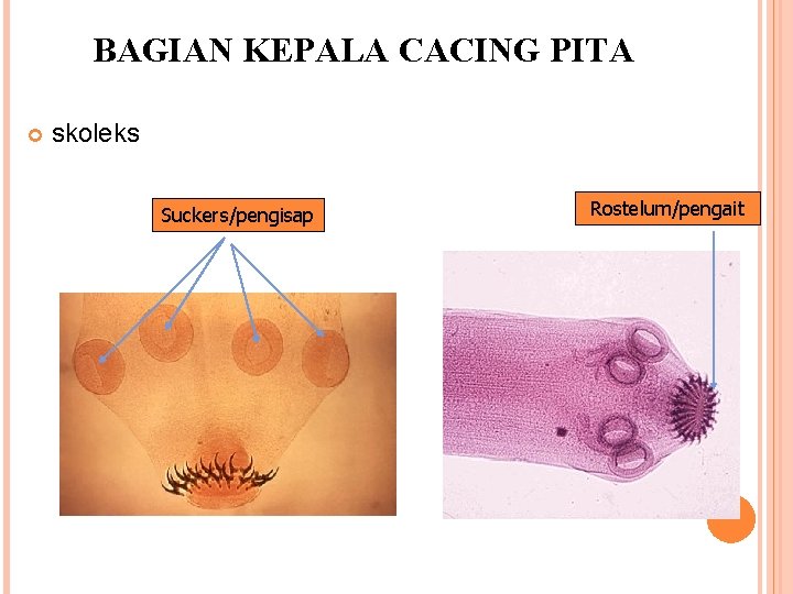 BAGIAN KEPALA CACING PITA skoleks Suckers/pengisap Rostelum/pengait 