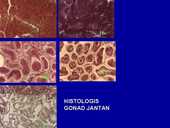 I II IV HISTOLOGIS GONAD JANTAN V 