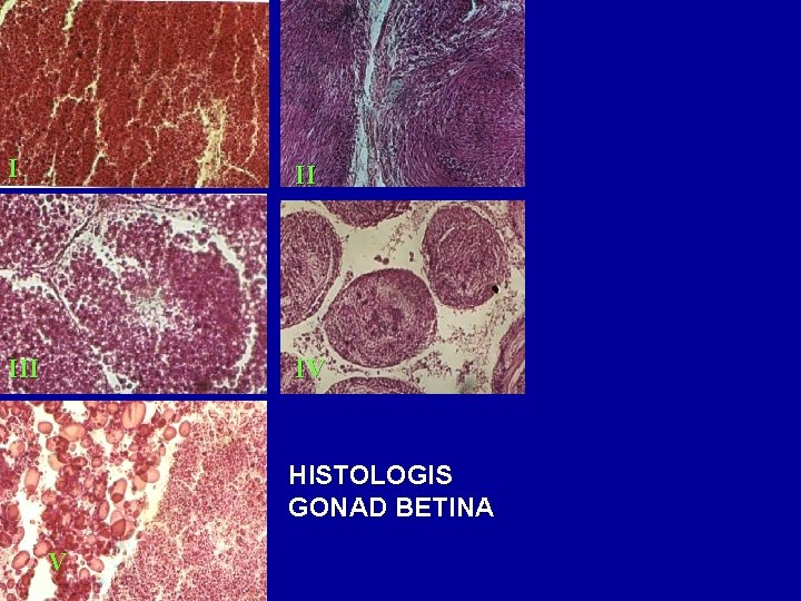 I II IV HISTOLOGIS GONAD BETINA V 