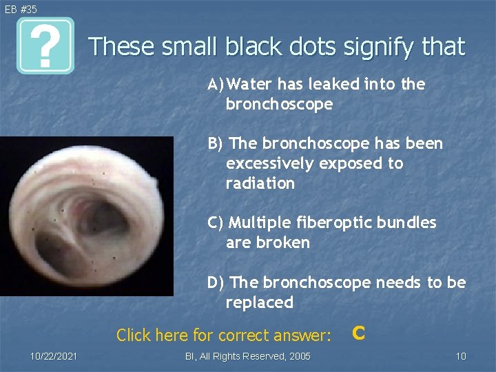 EB #35 These small black dots signify that A) Water has leaked into the