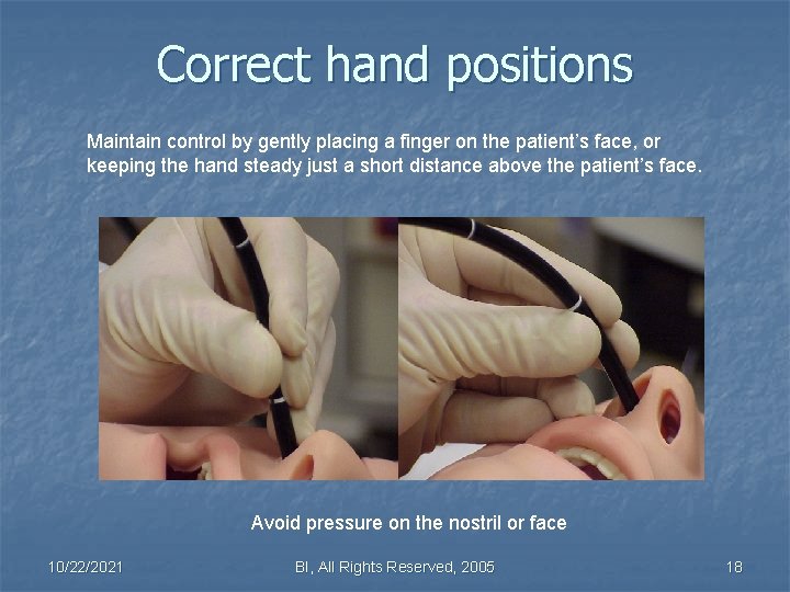 Correct hand positions Maintain control by gently placing a finger on the patient’s face,