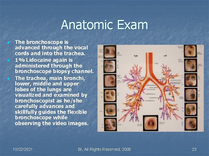 Anatomic Exam n n n The bronchoscope is advanced through the vocal cords and