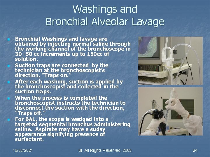 Washings and Bronchial Alveolar Lavage n n n Bronchial Washings and lavage are obtained