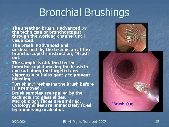 Bronchial Brushings n n n The sheathed brush is advanced by the technician or