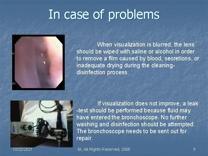 In case of problems When visualization is blurred, the lens should be wiped with