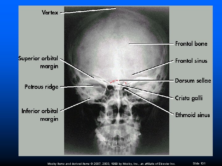 Mosby items and derived items © 2007, 2003, 1999 by Mosby, Inc. , an