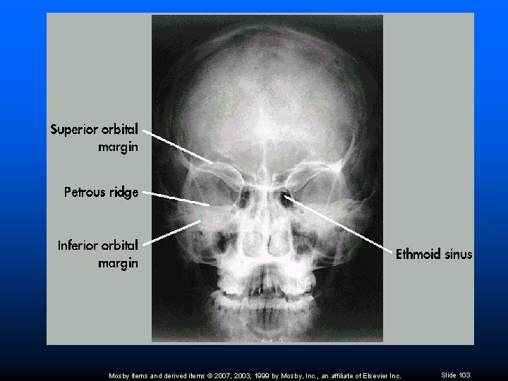 Mosby items and derived items © 2007, 2003, 1999 by Mosby, Inc. , an