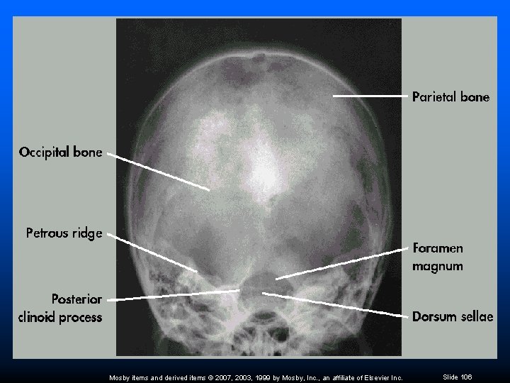 Mosby items and derived items © 2007, 2003, 1999 by Mosby, Inc. , an