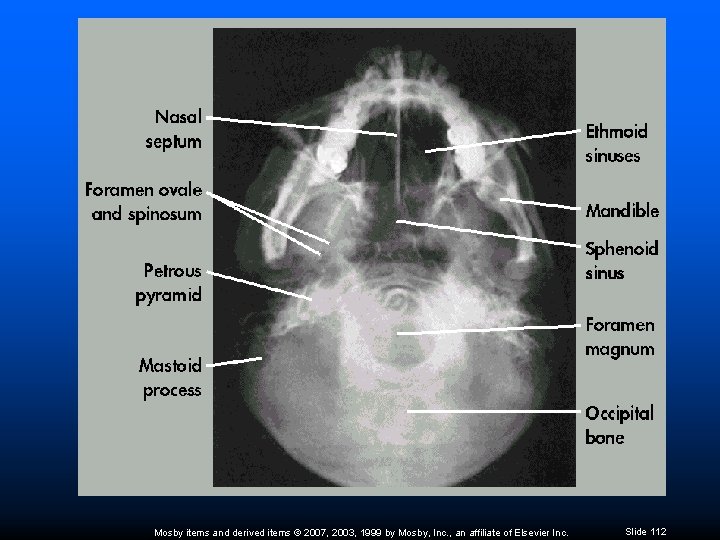 Mosby items and derived items © 2007, 2003, 1999 by Mosby, Inc. , an