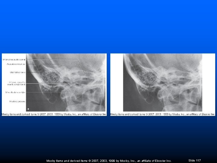 Mosby items and derived items © 2007, 2003, 1999 by Mosby, Inc. , an