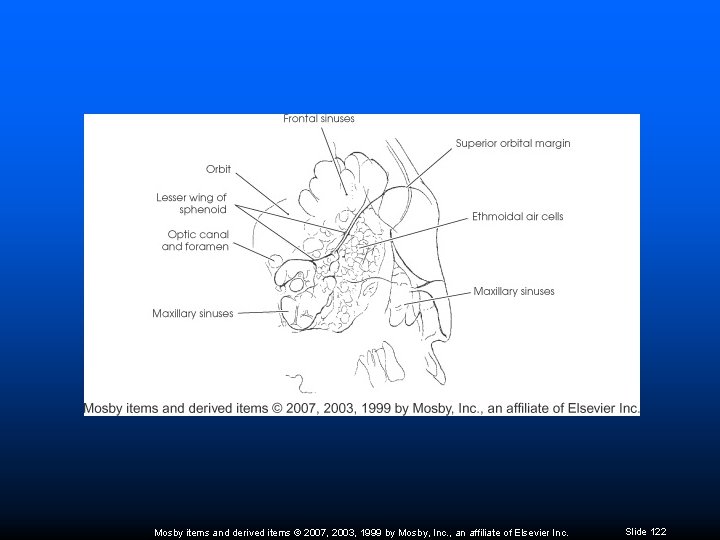 Mosby items and derived items © 2007, 2003, 1999 by Mosby, Inc. , an