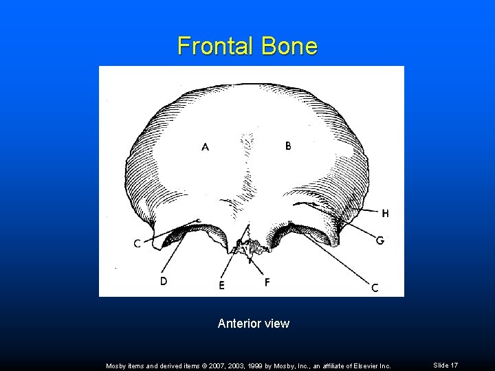 Frontal Bone Anterior view Mosby items and derived items © 2007, 2003, 1999 by