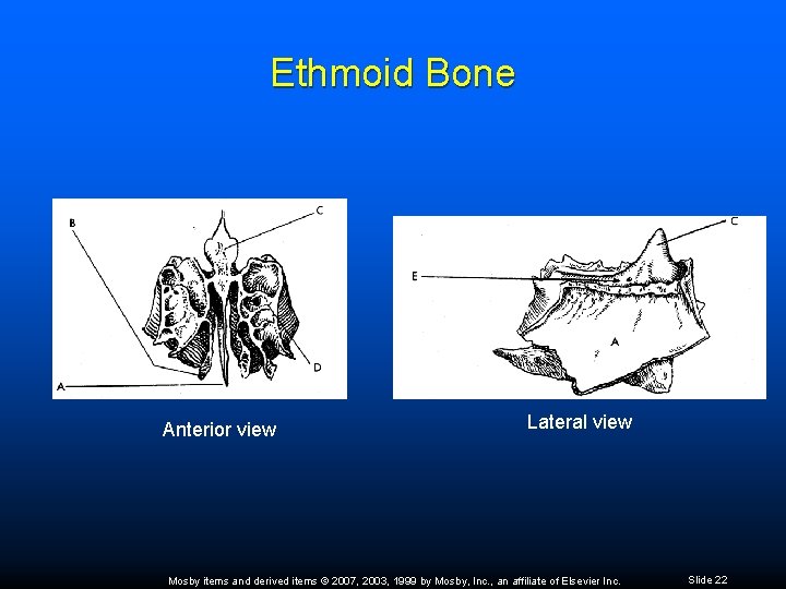 Ethmoid Bone Anterior view Lateral view Mosby items and derived items © 2007, 2003,