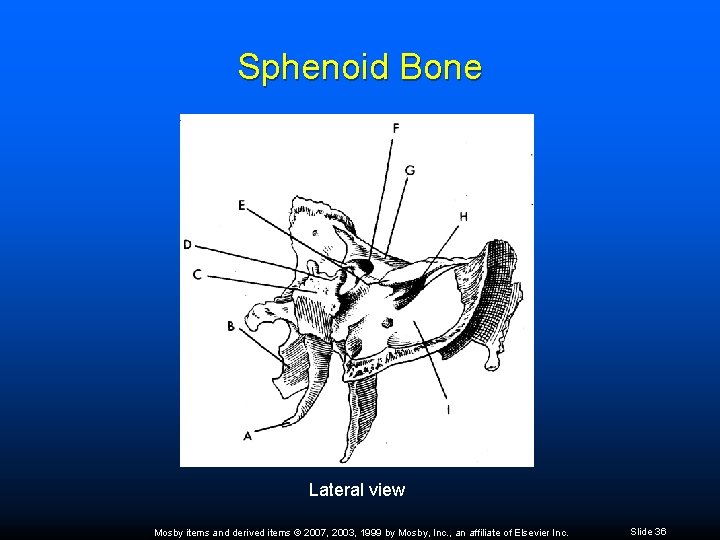 Sphenoid Bone Lateral view Mosby items and derived items © 2007, 2003, 1999 by