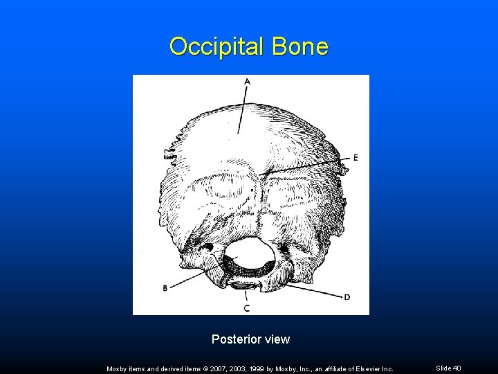 Occipital Bone Posterior view Mosby items and derived items © 2007, 2003, 1999 by