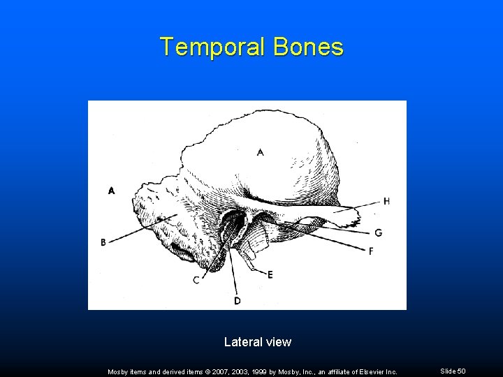 Temporal Bones Lateral view Mosby items and derived items © 2007, 2003, 1999 by