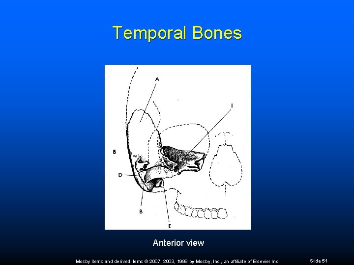 Temporal Bones Anterior view Mosby items and derived items © 2007, 2003, 1999 by