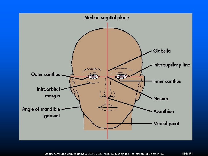 Mosby items and derived items © 2007, 2003, 1999 by Mosby, Inc. , an