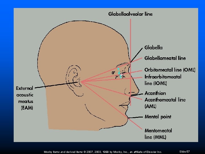 Mosby items and derived items © 2007, 2003, 1999 by Mosby, Inc. , an