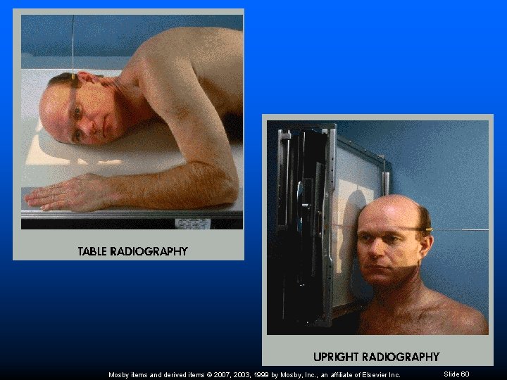 Mosby items and derived items © 2007, 2003, 1999 by Mosby, Inc. , an