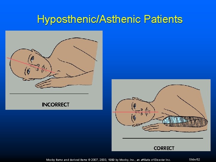 Hyposthenic/Asthenic Patients Mosby items and derived items © 2007, 2003, 1999 by Mosby, Inc.