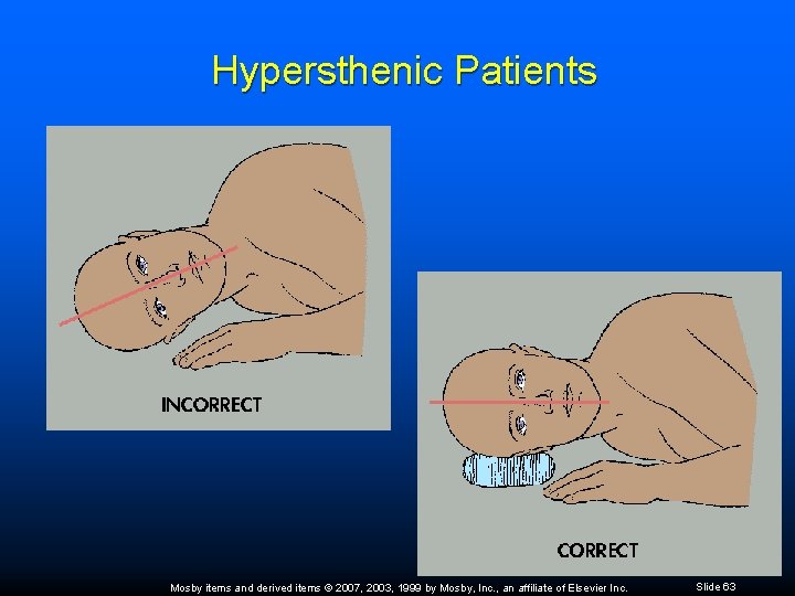 Hypersthenic Patients Mosby items and derived items © 2007, 2003, 1999 by Mosby, Inc.