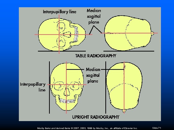 Mosby items and derived items © 2007, 2003, 1999 by Mosby, Inc. , an