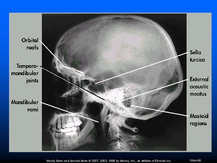 Mosby items and derived items © 2007, 2003, 1999 by Mosby, Inc. , an