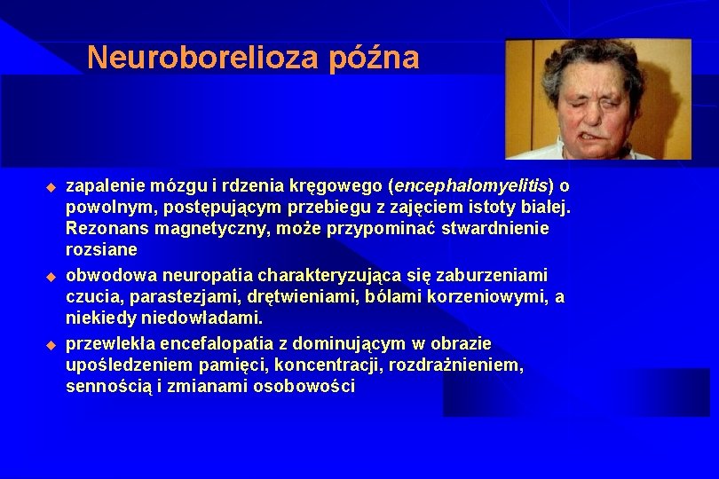 Neuroborelioza późna u u u zapalenie mózgu i rdzenia kręgowego (encephalomyelitis) o powolnym, postępującym